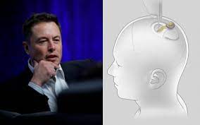 Neuralink de Elon Musk alista chip cerebral para primeros ensayos clínicos en humanos